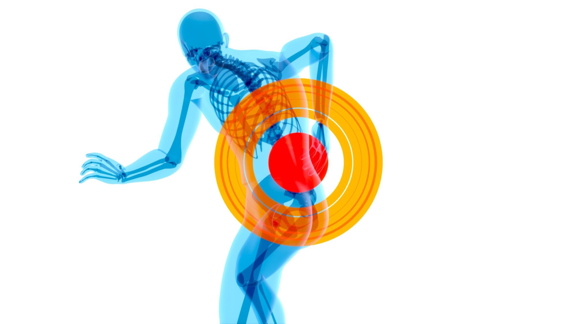 sciatica vs herniated disc